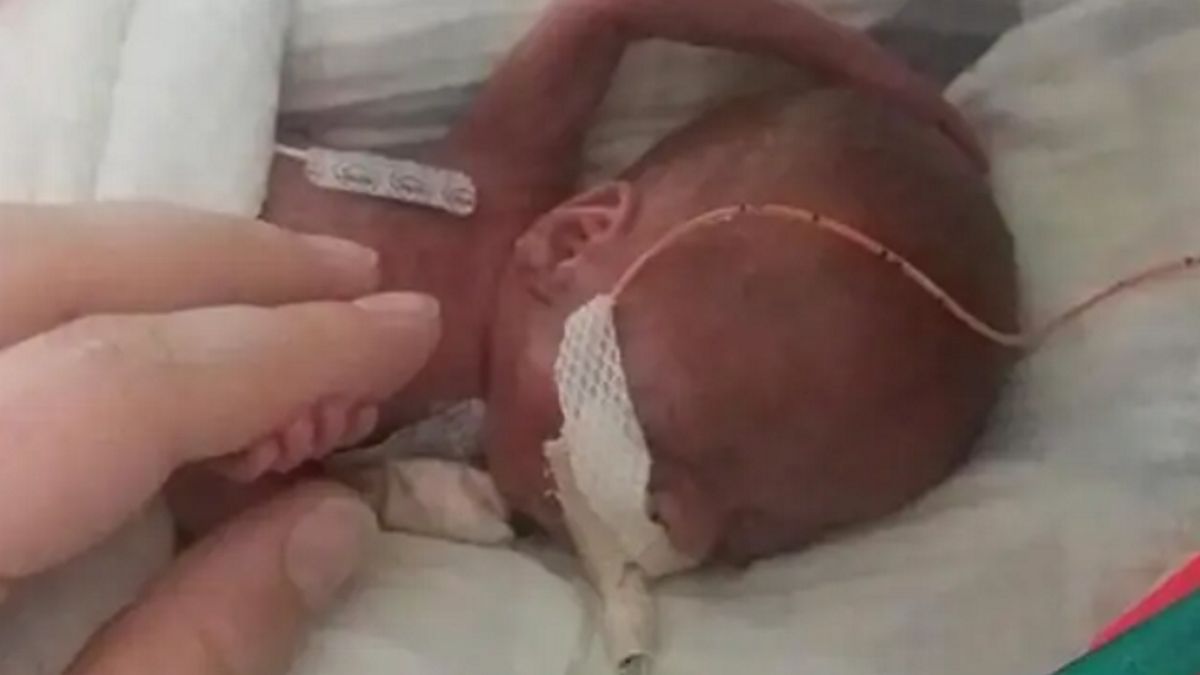 Noworodkowi nie dawano szans na przeżycie