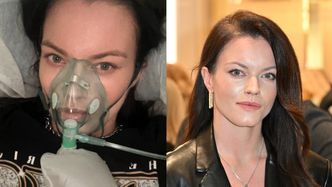 Agnieszka Skrzeczkowska z "Top Model" przeżyła chwile grozy. Po zabiegu powiększania ust "nastąpiła martwica tkanek"