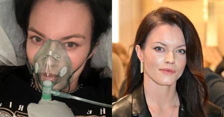 Agnieszka Skrzeczkowska z "Top Model" przeżyła chwile grozy. Po zabiegu powiększania ust "nastąpiła martwica tkanek"