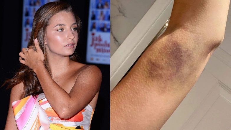 Julia Wieniawa przeprasza medyka