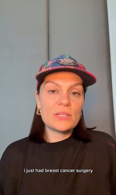 Jessie J