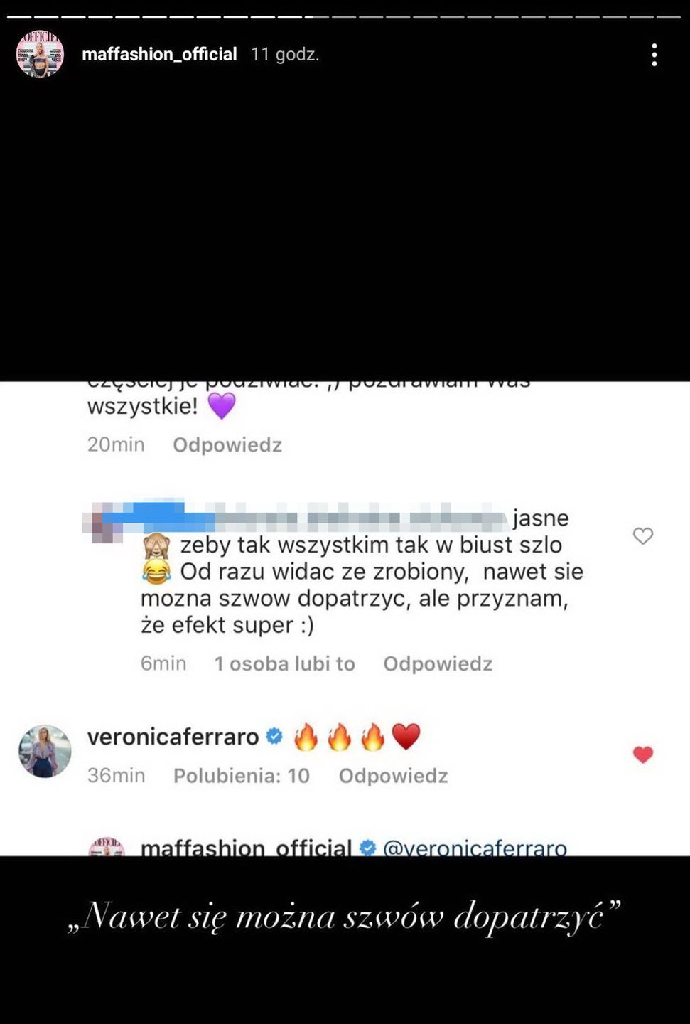 Maffashion odpiera zarzuty o powiększenie biustu i apeluje o empatię