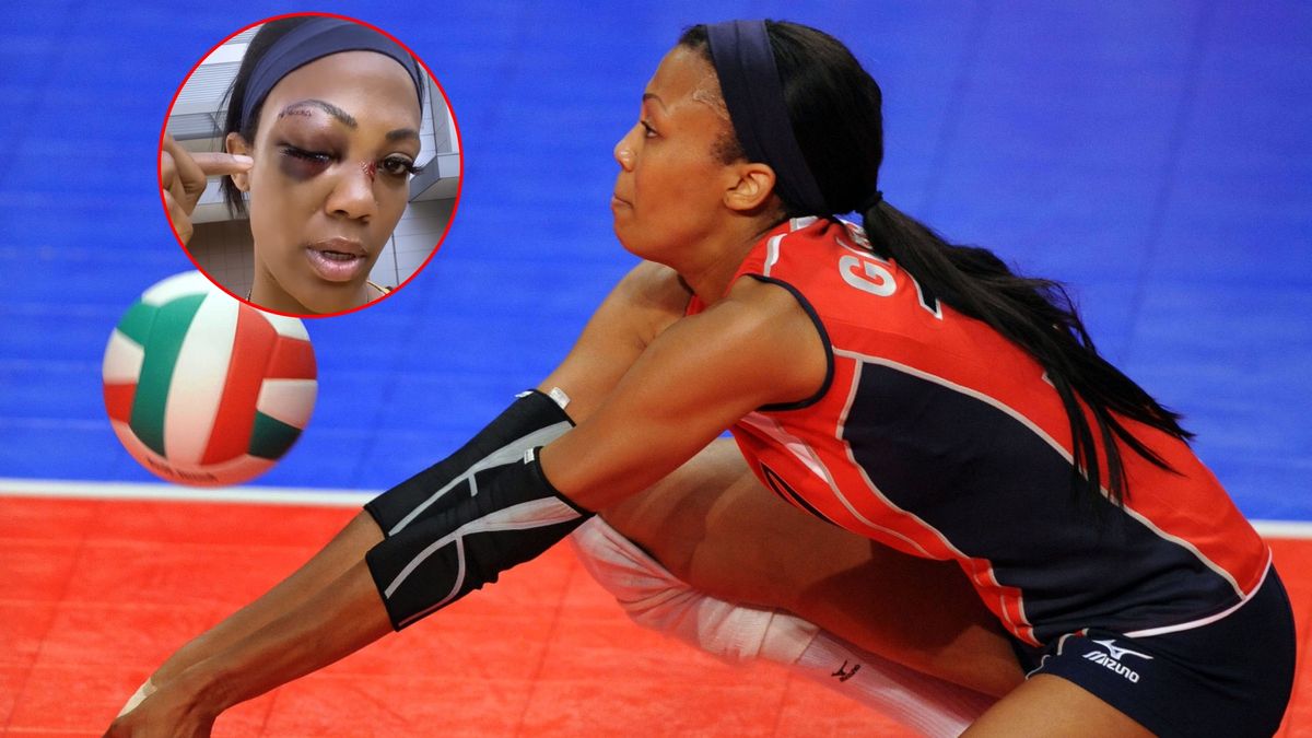 Kim Glass została brutalnie zaatakowana 