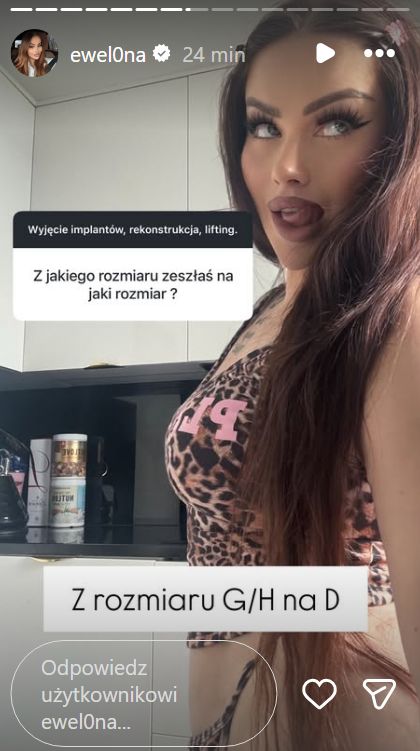 Ewelona zmniejszyła biust