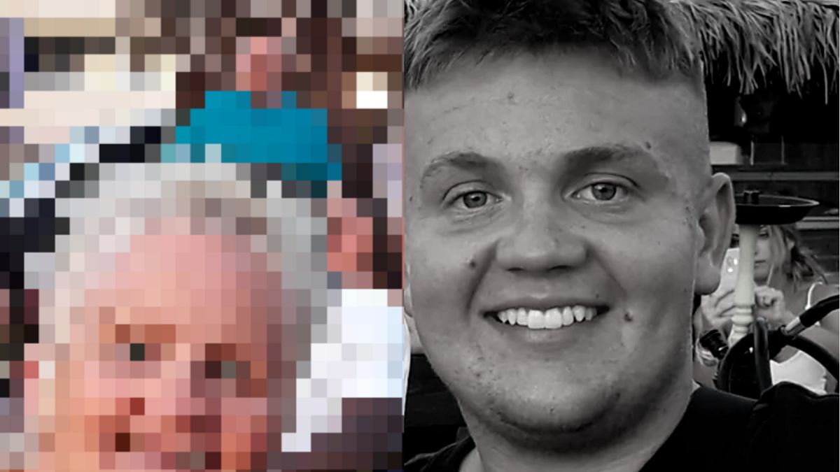 Pojechał do Turcji na operację zmniejszania żołądka. Nie przeżył zabiegu