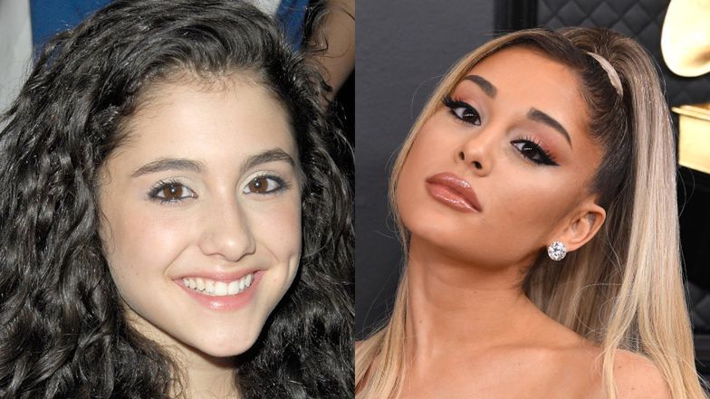 Gwiazdy, które zrobiły sobie nos