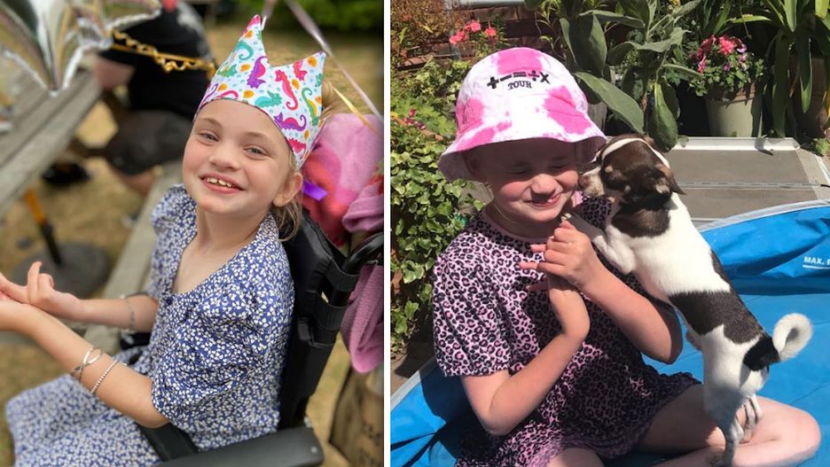 Dziewczynka zaczęła wyrywać sobie włosy z głowy. Okazało się, że to rzadkie schorzenie