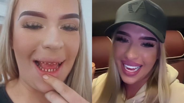 Polka zafundowała sobie "tureckie zęby"