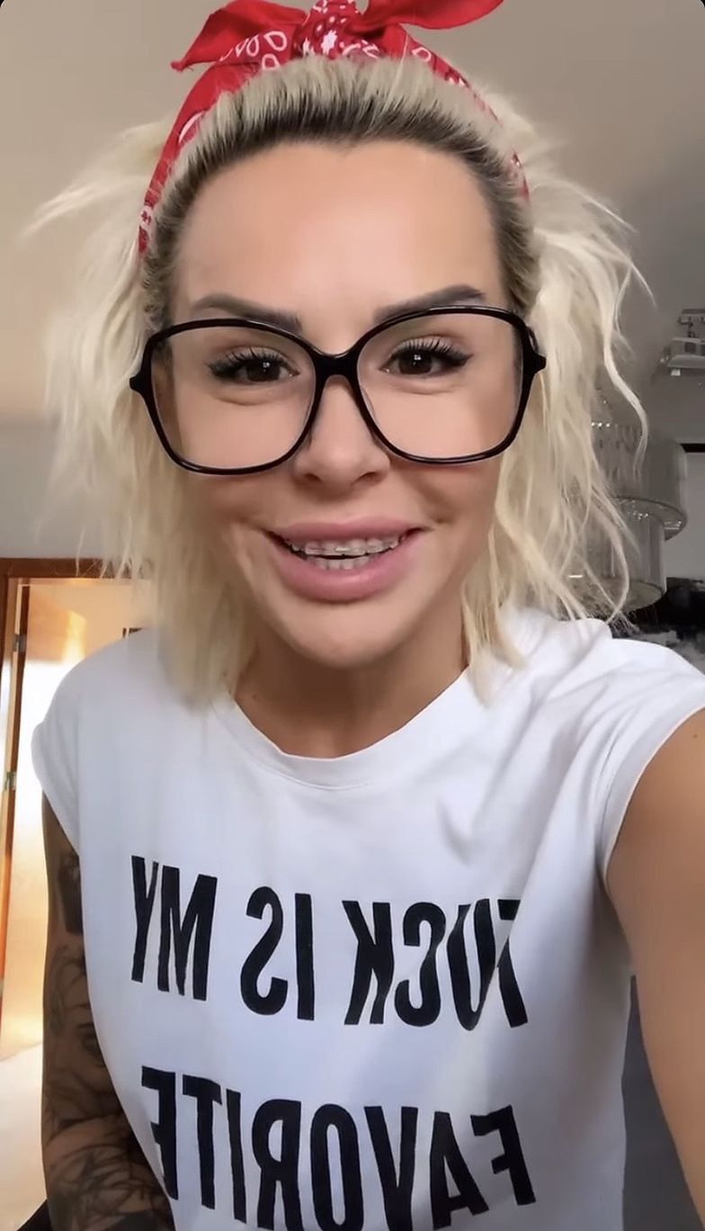 Blanka Lipińska zdjęła aparat i podcięła dziąsła