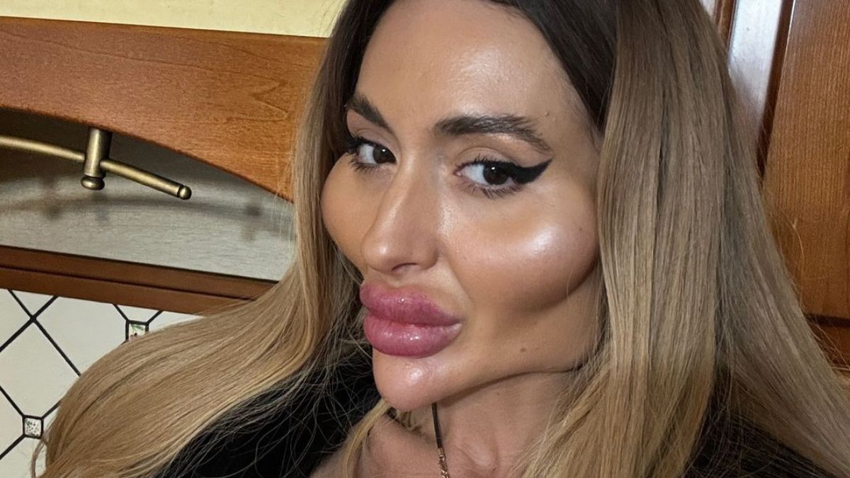 Anastasia Pokreshchuk jest posiadaczką największych policzków na świecie