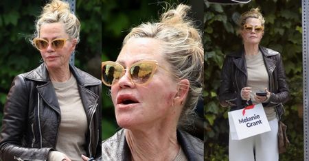 Niepokojące zdjęcia Melanie Griffith. Gwiazda opuściła SPA z sińcami i zranieniami twarzy (ZDJĘCIA)