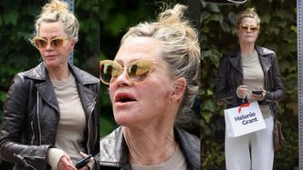 Niepokojące zdjęcia Melanie Griffith. Gwiazda opuściła SPA z sińcami i zranieniami twarzy (ZDJĘCIA)