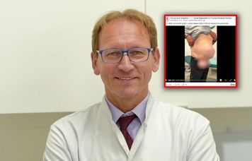 Operuje pacjentów z przepuklinami. "Latami wstydzą się rozebrać"