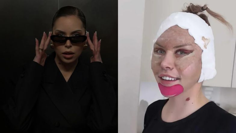 Julia von Stein pokazała się po liftingu