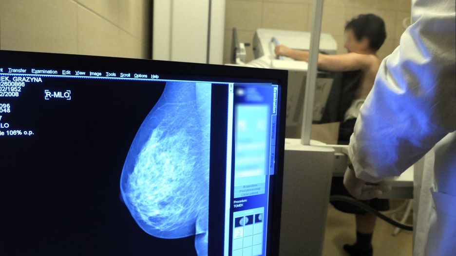 Profilaktyka raka piersi to najważniejsza rzecz w drodze po zdrowie.