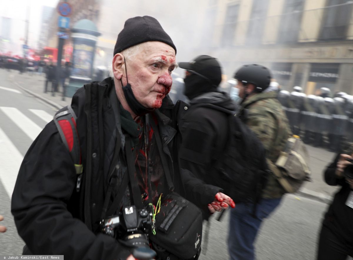 Fotoreporter Tomasz Gutry postrzelony w Dzień Niepodległości. Szef KSP chce wyjaśnienia sprawy