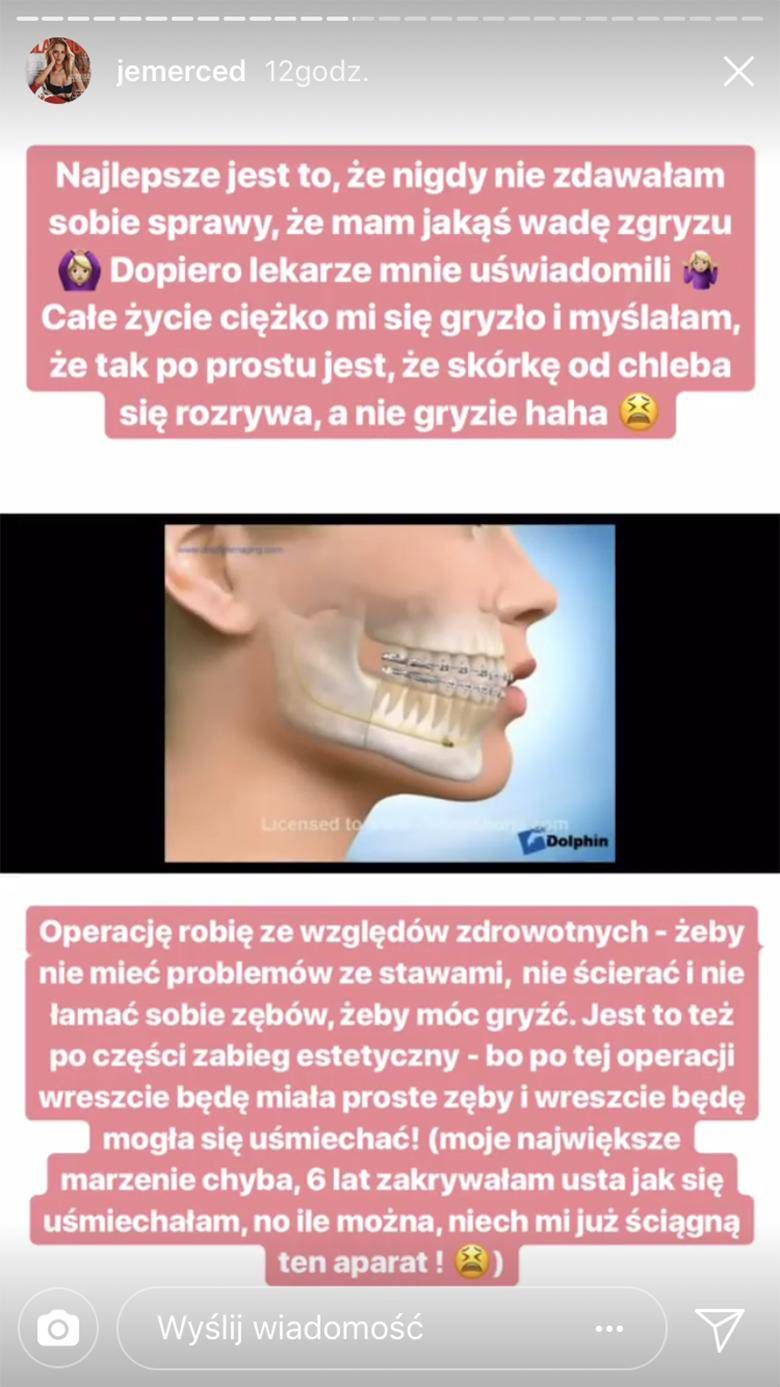 Jessica Mercedes będzie miała łamaną szczękę