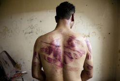Przemoc seksualna wobec mężczyzn jest powszechna. Nowy raport o syryjskich więzieniach