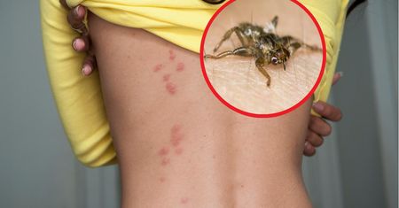 "Latające kleszcze" atakują chmarami. "Ugryzienia mogą być dotkliwe"