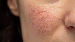 Spójrz w lustro. Jeden szczegół zdradza, że wątroba jest na wykończeniu