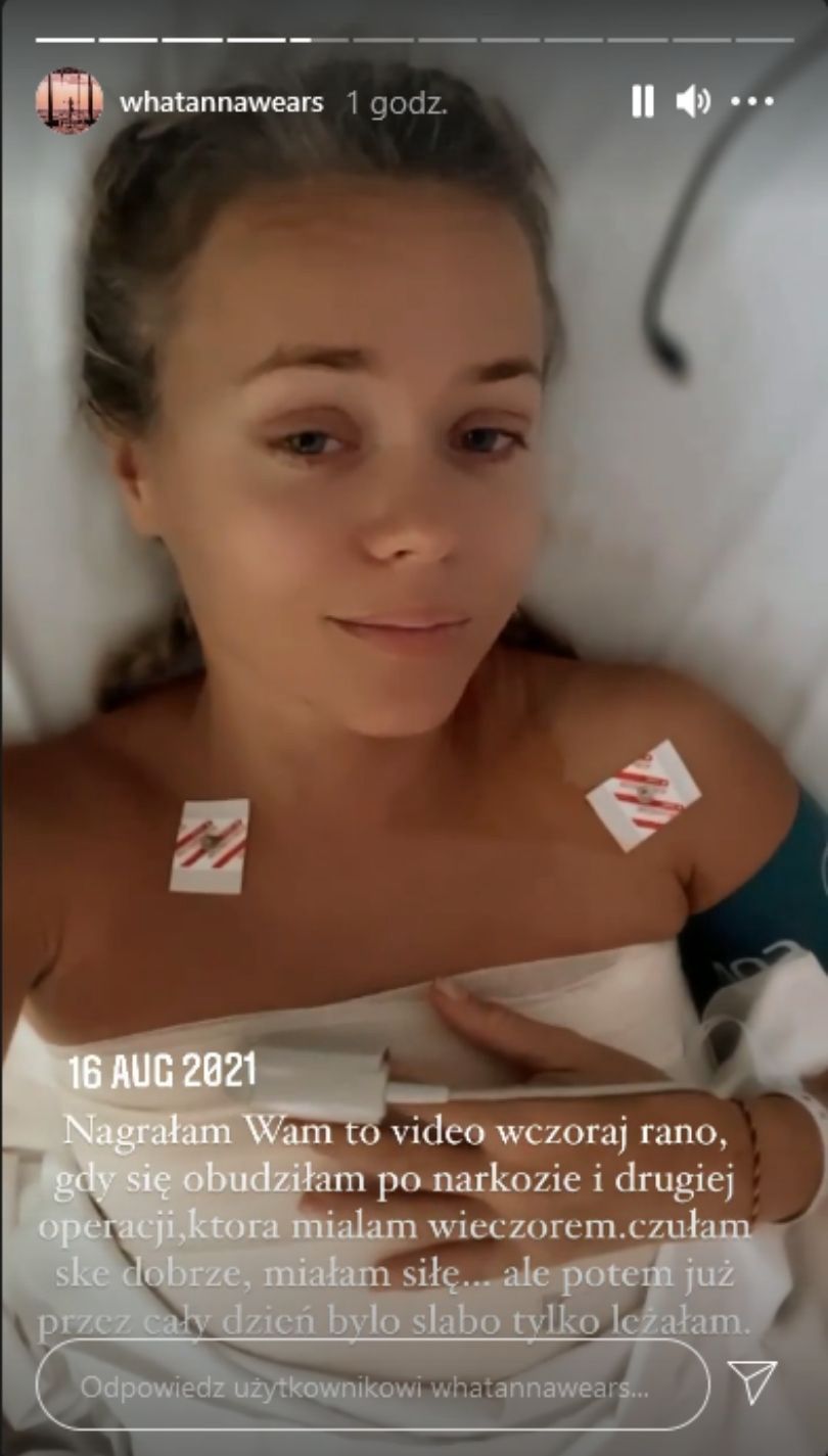 Anna Skura znów wspomina operację