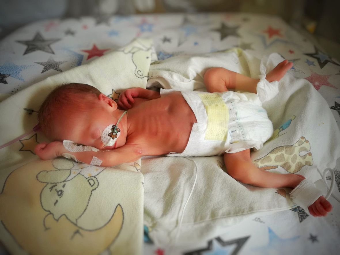 &quot;Pani syn ma trisomię&quot;