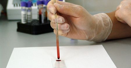 Niewielki odsetek Polaków robi testy na HIV