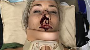 Koszmarny wypadek australijskiej kolarki. Pokazała zdjęcia ze szpitala