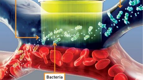 Elektromagnes, który odfiltruje bakterie z krwioobiegu 1