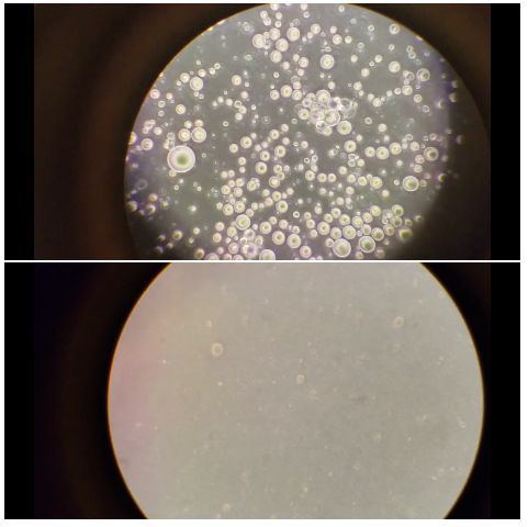 Różnica między mlekiem matki, a modyfikowanym pod mikroskopem