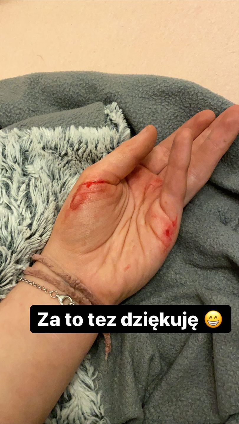 Julia Wróblewska została pobita na Strajku Kobiet w Warszawie