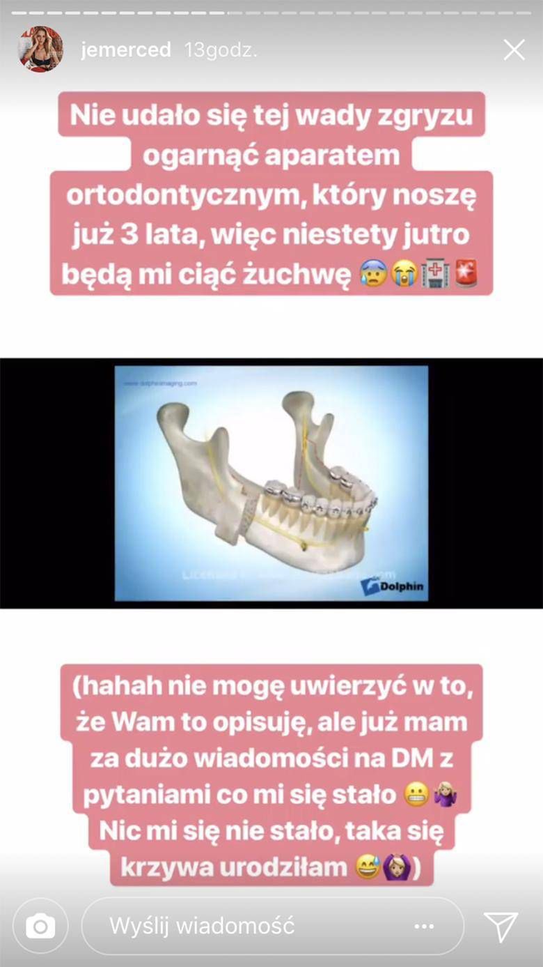 Jessica Mercedes będzie miała łamaną szczękę