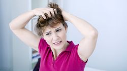 Dlaczego swędzi mnie skóra głowy?