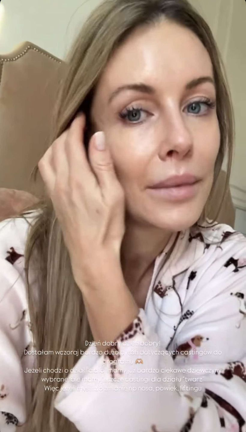 Małgorzata Rozenek prezentuje "naturalne" oblicze z rana