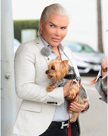 Rodrigo Alves - żywy Ken wyciął sobie cztery żebra