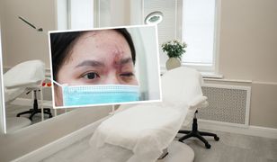 Dramat 17-latki. Straciła wzrok po zabiegu upiększającym w Wietnamie