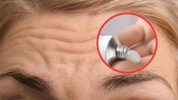 Perełka z apteki. Smaruj na noc, a rano zobaczysz różnicę