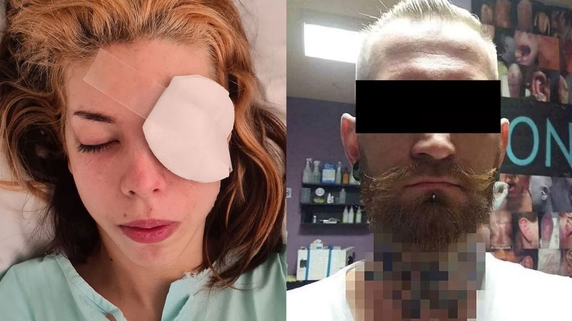 Wrocławianka od kilku lat całkowicie nie widzi na jedno oko, a drugie musiała usunąć. Piotr A. nadal prowadzi salon w Warszawie