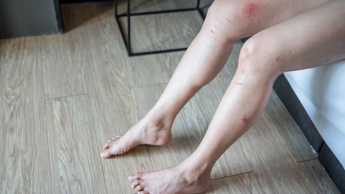 Objawy chorób często pojawiają się na nogach