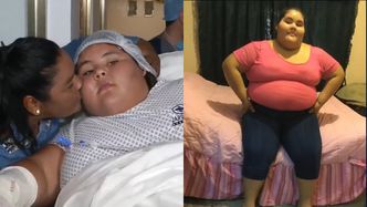 "Najgrubsza nastolatka świata" przeszła przemianę. W wieku 14 lat ważyła 195 kg, a teraz jest nie do poznania (FOTO)