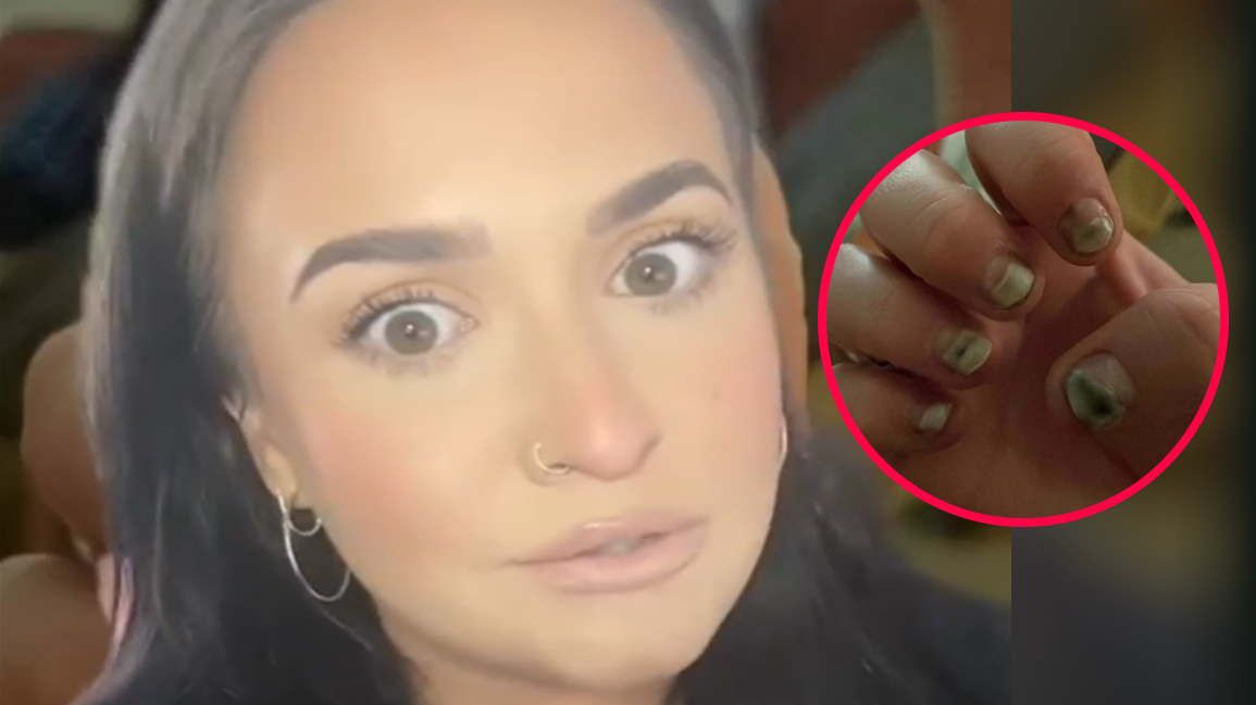 Jej paznokcie zrobiły się czarne