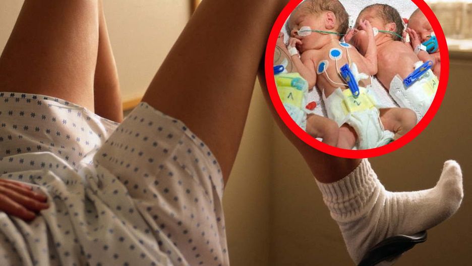 Rodzice w szoku: podczas porodu trojaczków okazało się, że w łonie matki było jeszcze czwarte dziecko
