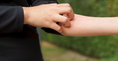 Skuteczne sposoby na ukąszenia komarów