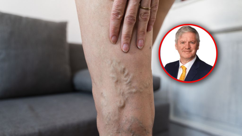 Gdy robi się chłodno, naczynia krwionośne mają tendencję do zwężania się, a krew może płynąć wolniej