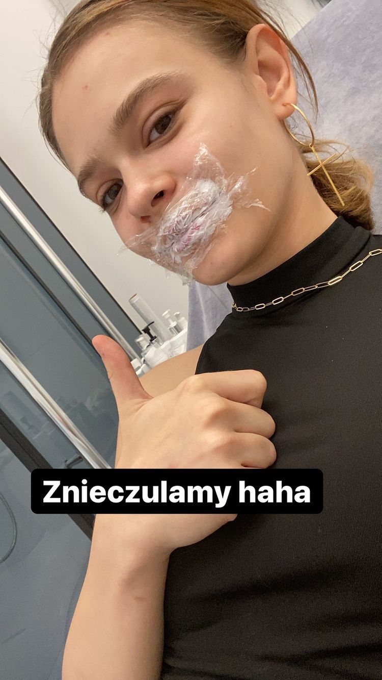 Julia Wróblewska powiększyła usta