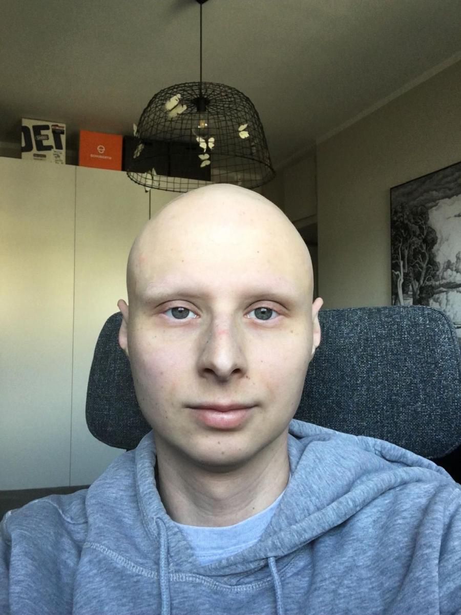 W Polsce Kuba nie ma już możliwości leczenia