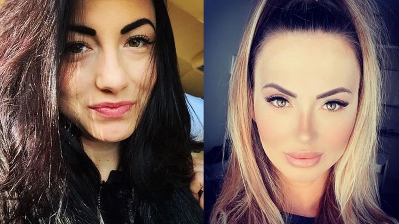 Ola z "Love Island" chwali się operacjami 