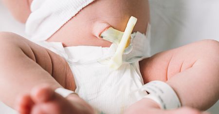Kikut pępowinowy: kiedy powinien odpaść?