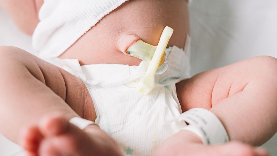 Kikut pępowinowy: kiedy powinien odpaść?