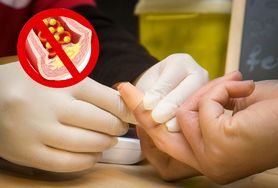 Oto nowe normy cholesterolu i lipdów. Ten poziom niesie ryzyko konsekwencji zdrowotnych